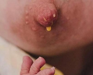colostrum